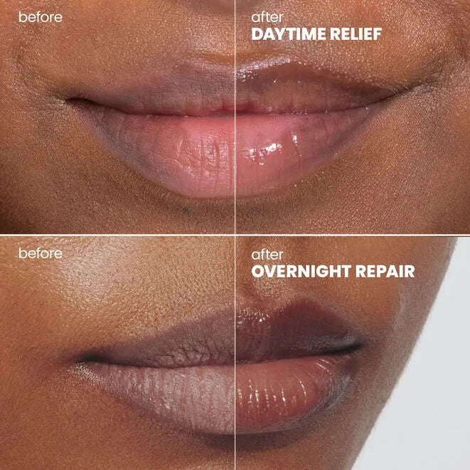 Rescue Lip Relief