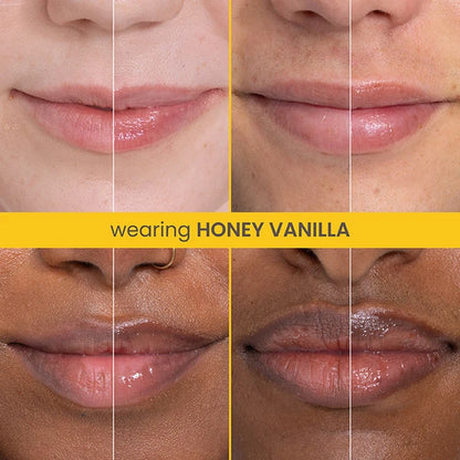 Rescue Lip Relief