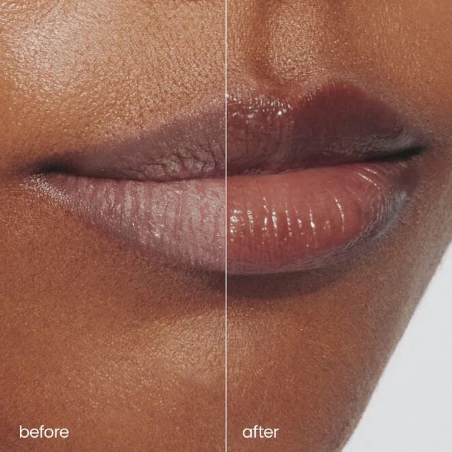 Rescue Lip Relief