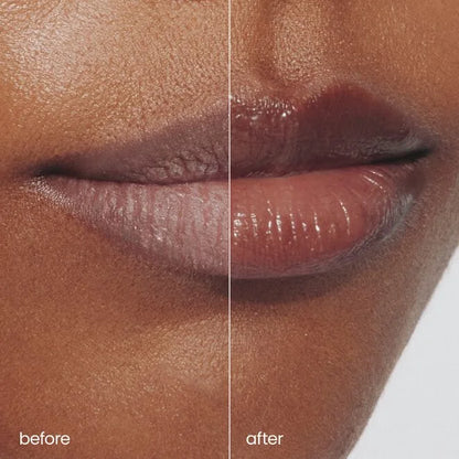 Rescue Lip Relief
