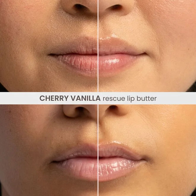 Rescue Lip Butter - Cherry Vanilla